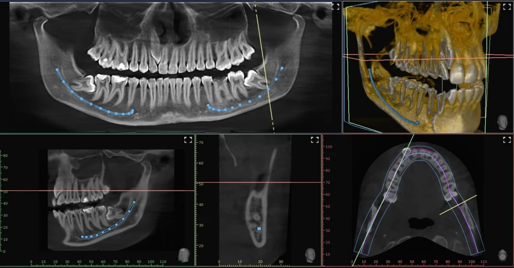 Cone Beam, Panoramique et radiographies en 3D au cabinet du Dr Rolland Orthodontiste à La Fare les Oliviers